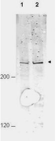 Western blot using Boster