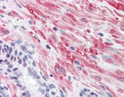 Immunohistochemistry with Anti-Glycogen Synthase antibody