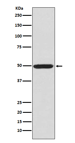 p03911 wb