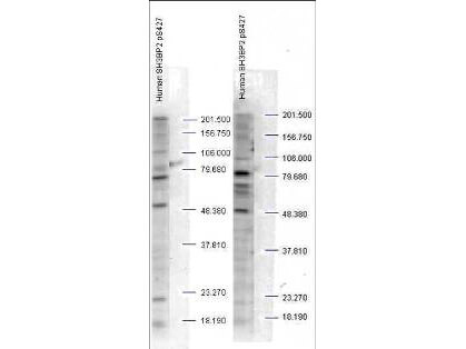 Western blot analysis is shown using Boster's Affinity Purified anti-SH3BP2 pS427 antibody to detect endogenous protein present in unstimulated human whole cell lysates