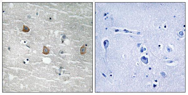 Immunohistochemistry analysis of paraffin-embedded human brain, using TOB1 (Phospho-Ser164) Antibody