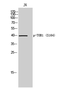 Western Blot analysis of JK cells using Phospho-TOB1 (S164) Polyclonal Antibody