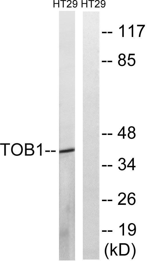 Western blot analysis of lysates from HT29 cells treated with serum 20% 15