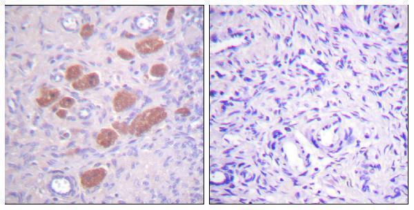 p04208 ncf4 primary antibodies ihc testing 2