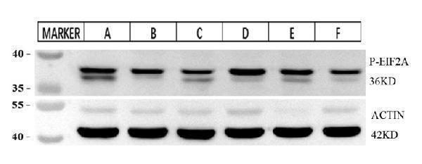p04387 eif2s1 primary antibodies wb testing 2