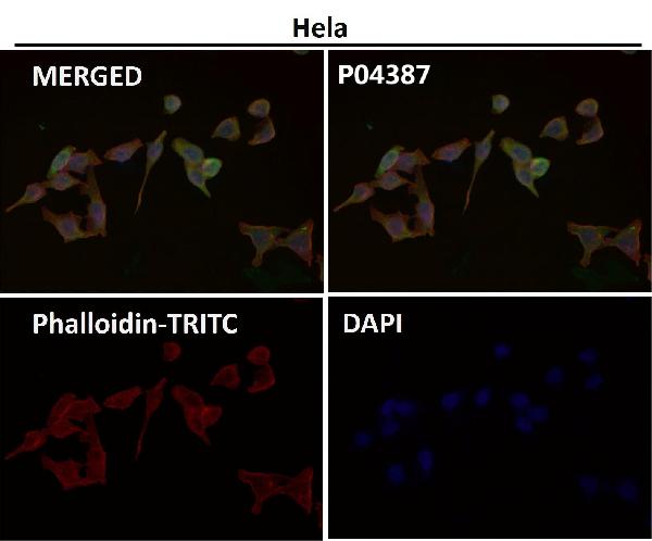 Immunofluorescent analysis using the Antibody at 1:50 dilution. Immunofluorescent analysis using the Antibody at 1:50 dilution.