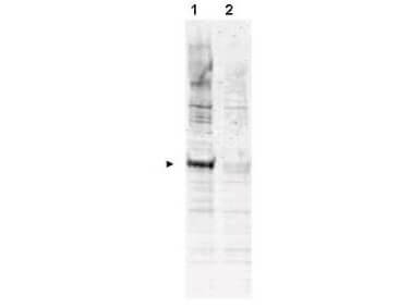 Western blot using Boster's Affinity Purified anti-APC6 pT580 antibody shows detection of a band ~72 kDa corresponding to phosphorylated human APC6 (arrowhead lane 1)