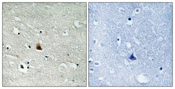 Immunohistochemical analysis of paraffin-embedded Human brain