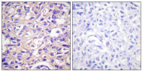 p04850 tk1 primary antibodies ihc testing 2