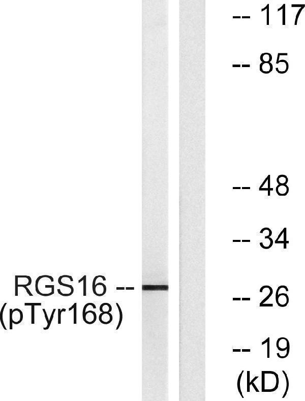 Western blot analysis of lysates from COS7 cells treated with heat shock, using RGS16 (Phospho-Tyr168) Antibody