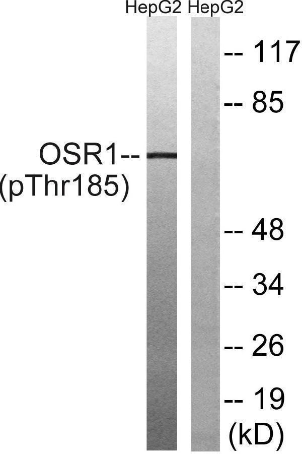 Western blot analysis of lysates from HepG2 cells treated with serum 20% 15