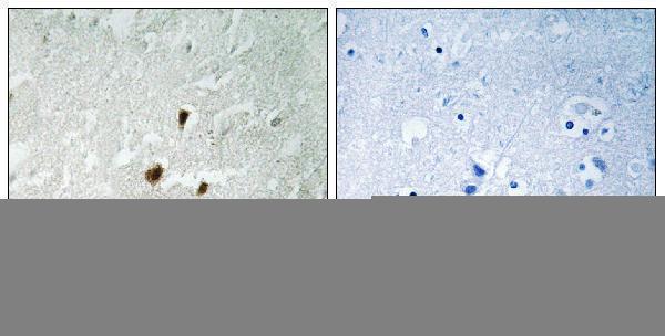 p05439 rrn3 primary antibodies ihc testing 2