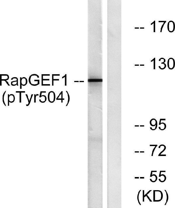 Western blot analysis of lysates from HepG2 cells treated with Na3VO4 0