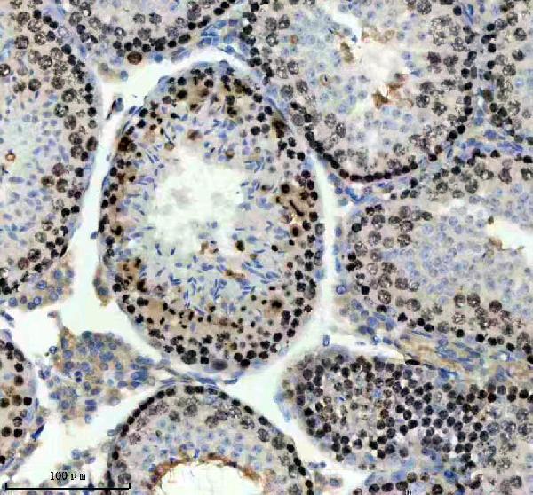 p06652 p h1 4 primary antibodies ihc testing 10