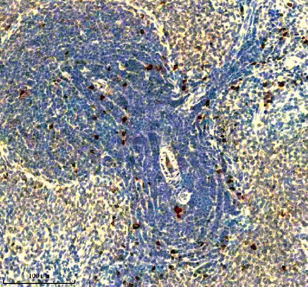 p06652 p h1 4 primary antibodies ihc testing 11