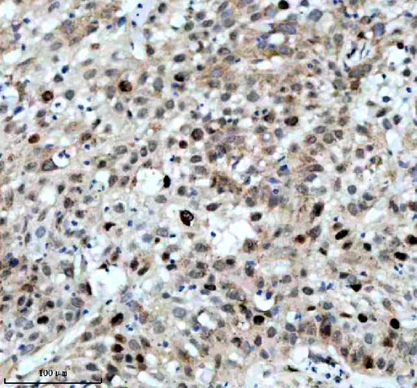 p06652 p h1 4 primary antibodies ihc testing 2