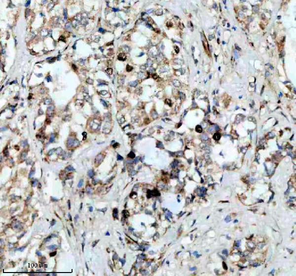 p06652 p h1 4 primary antibodies ihc testing 3