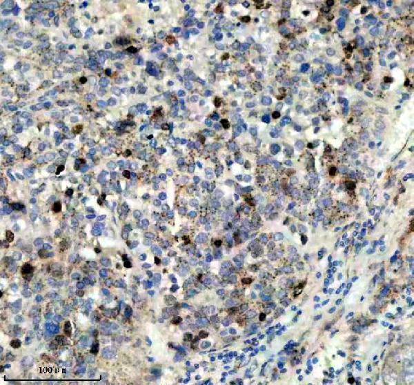 p06652 p h1 4 primary antibodies ihc testing 4