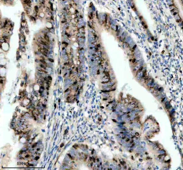 p06652 p h1 4 primary antibodies ihc testing 5