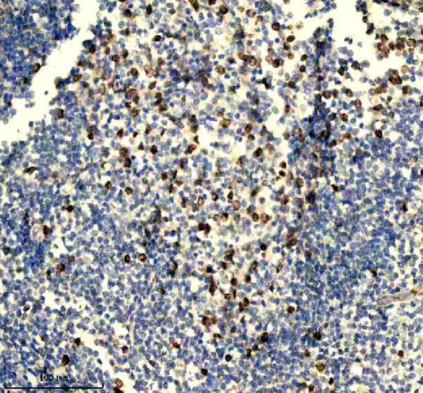 p06652 p h1 4 primary antibodies ihc testing 6