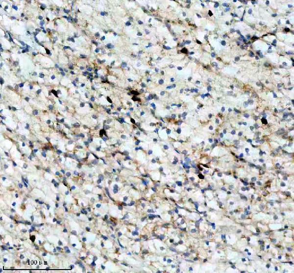 p06652 p h1 4 primary antibodies ihc testing 7