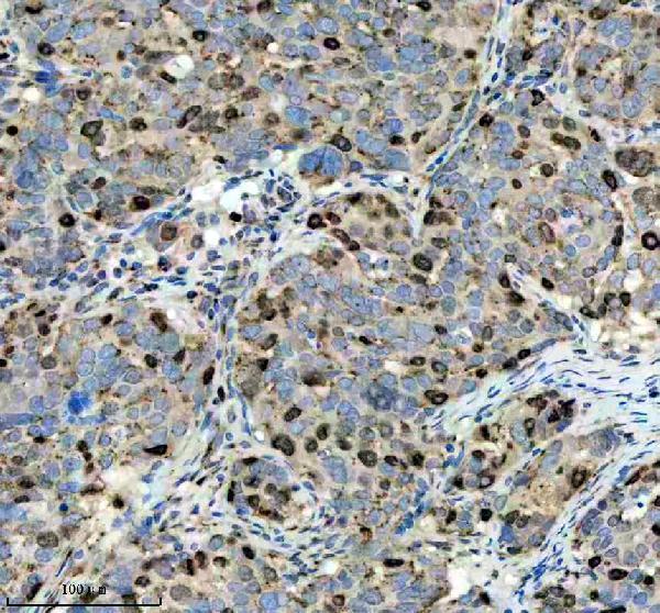 p06652 p h1 4 primary antibodies ihc testing 8