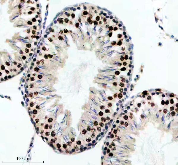 p06652 p h1 4 primary antibodies ihc testing 9