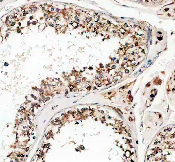 p06762 1 p lipe primary antibodies ihc testing 1