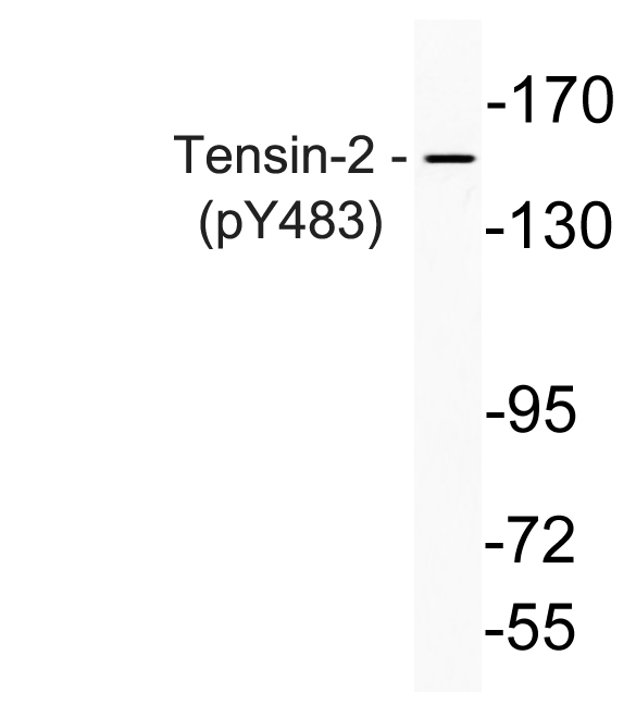 Western blot analysis of lysate from K562 cells, using phospho-Thrensin-2 (Phospho-Tyr483) antibody 