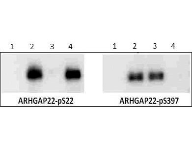 Western Blot of Rabbit anti-ARHGAP22 pS22 antibody