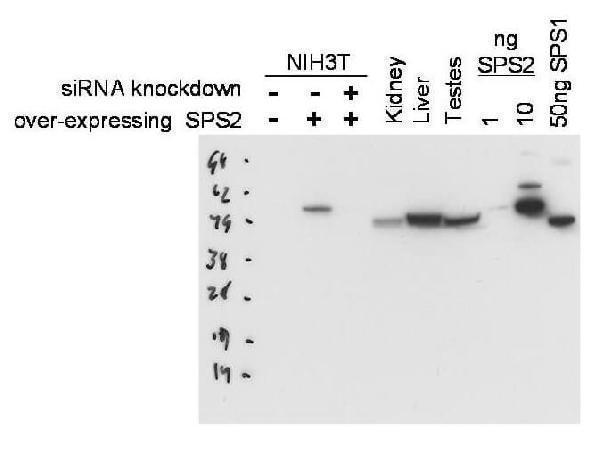 p11872 sephs2 primary antibodies wb testing 1