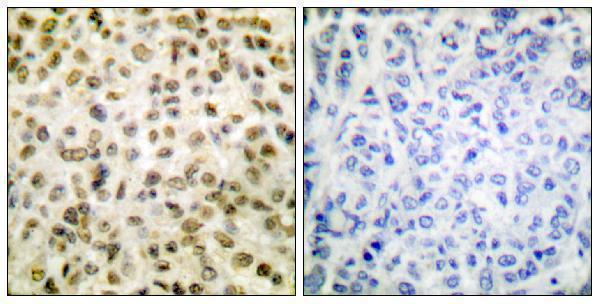 p12111 h1foo primary antibodies ihc testing 1