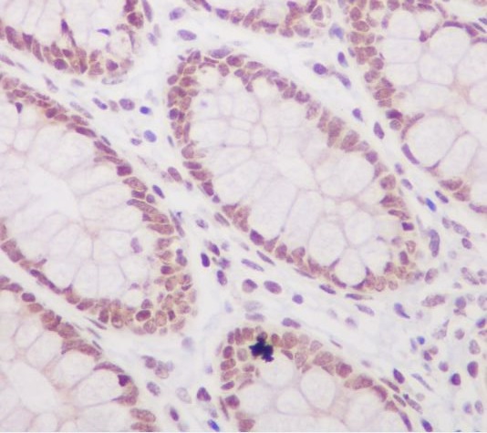 p12477 1 ihc