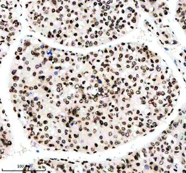 p12477 2 histone h3 primary antibodies ihc testing 3