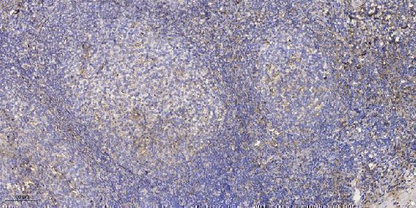 p15343 znf598 primary antibodies ihc testing 2