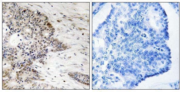 p16777 hist1h2ag primary antibodies ihc testing 2