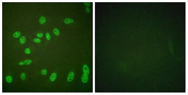 Immunofluorescence analysis of HeLa cells treated with PMA 125ng/ml 30