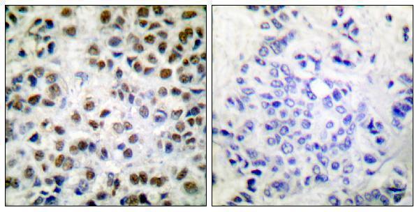 p30431 polr2a primary antibodies ihc testing 3