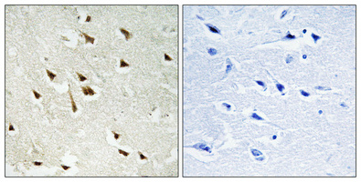 Immunohistochemical analysis of paraffin-embedded Human brain