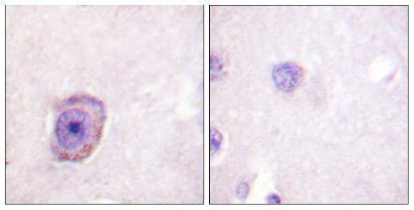 Immunohistochemistry analysis of paraffin-embedded human brain, using Rhodopsin (Phospho-Ser334) Antibody