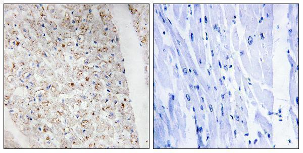 p30439 prkd1 primary antibodies ihc testing 2