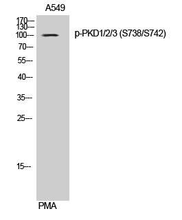 p30439 prkd1 primary antibodies wb testing 3