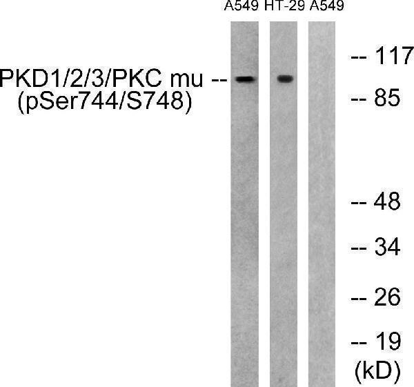p30439 prkd1 primary antibodies wb testing 4