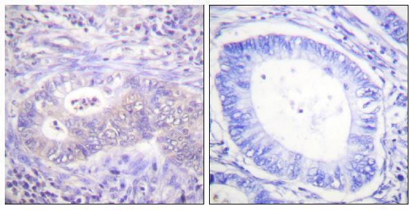 p30440 pfkfb2 primary antibodies ihc testing 2