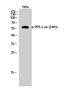 p30440 pfkfb2 primary antibodies wb testing 3