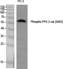 p30440 pfkfb2 primary antibodies wb testing 4