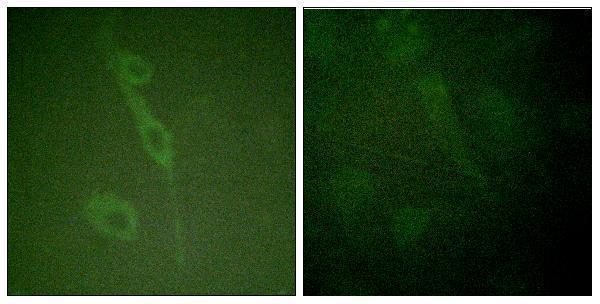 Immunofluorescence analysis of HUVEC cells, using IL-7R/CD127 (Phospho-Tyr449) Antibody