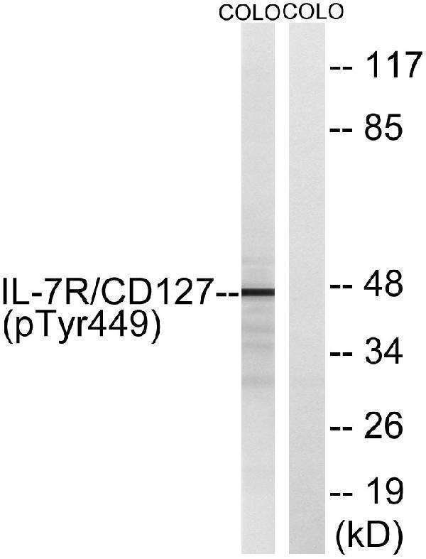 Western blot analysis of lysates from COLO205 cells, using IL-7R/CD127 (Phospho-Tyr449) Antibody