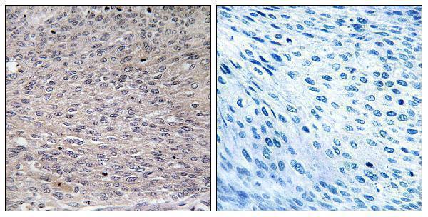p30450 aco1 primary antibodies ihc testing 2