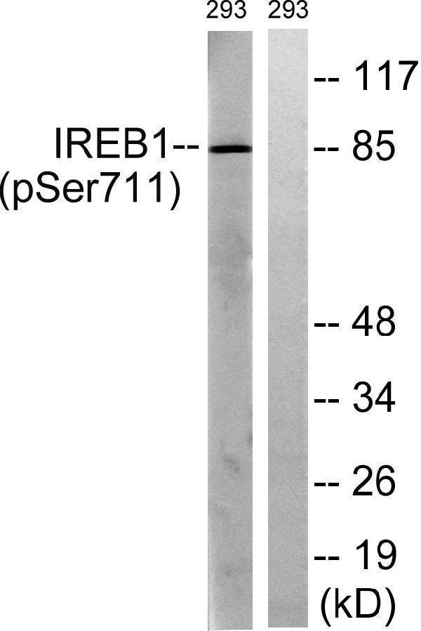 p30450 aco1 primary antibodies wb testing 4